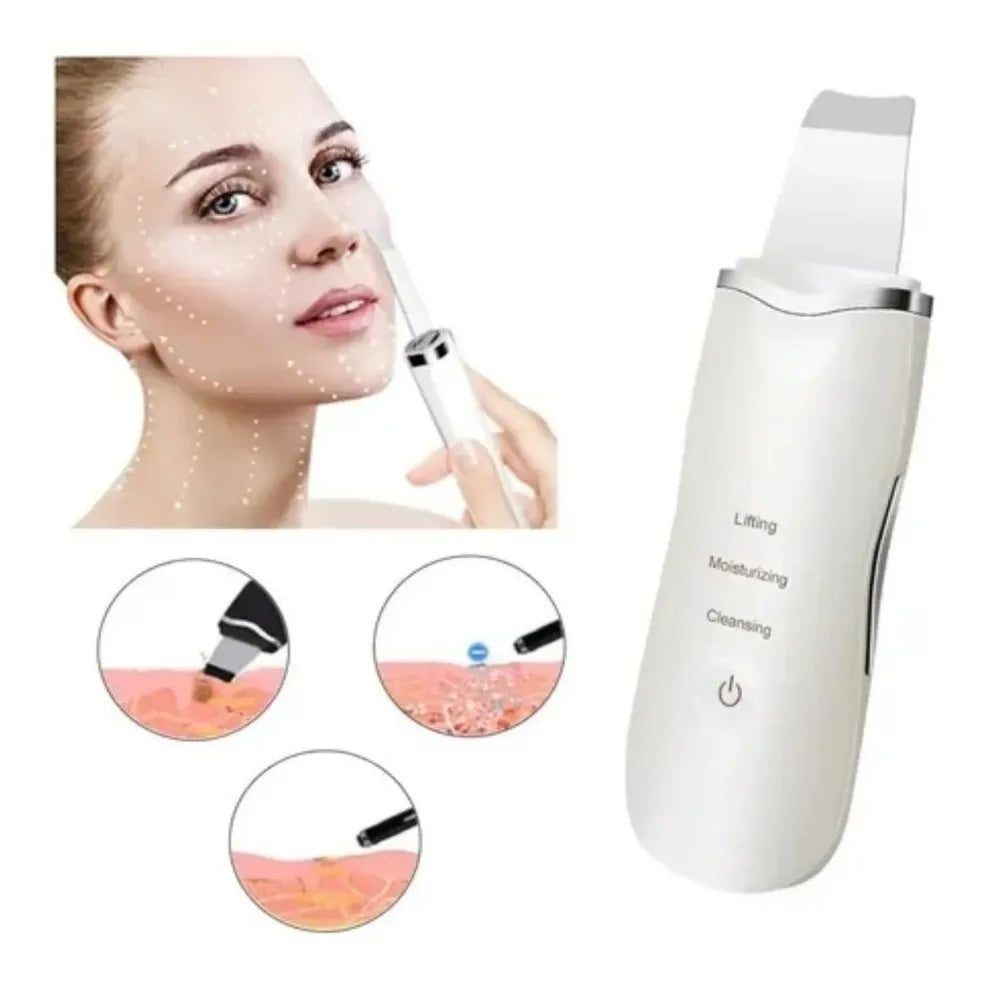 Limpiador Peeling Facial Ultrasónico – Libera tus poros, favorece la absorción y mejora la apariencia de la piel