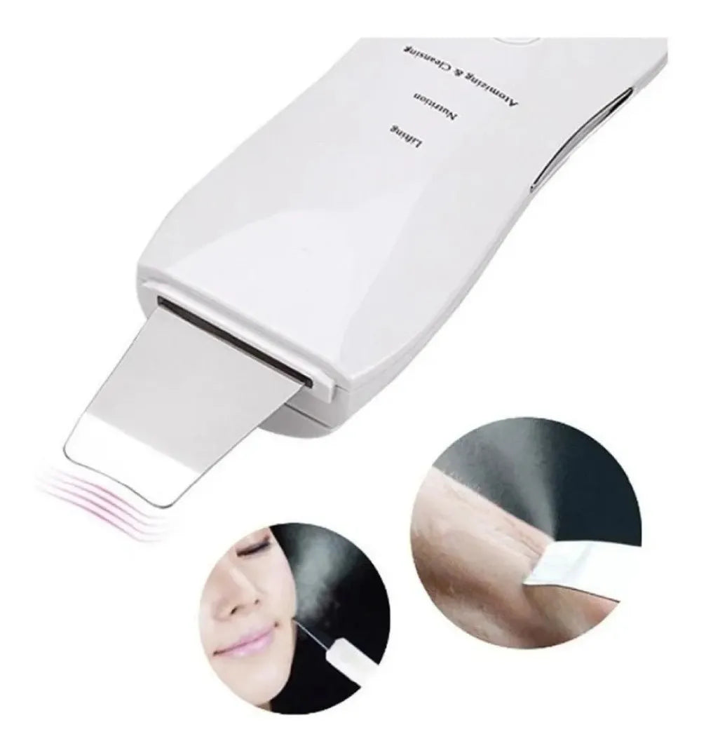 Limpiador Peeling Facial Ultrasónico – Libera tus poros, favorece la absorción y mejora la apariencia de la piel