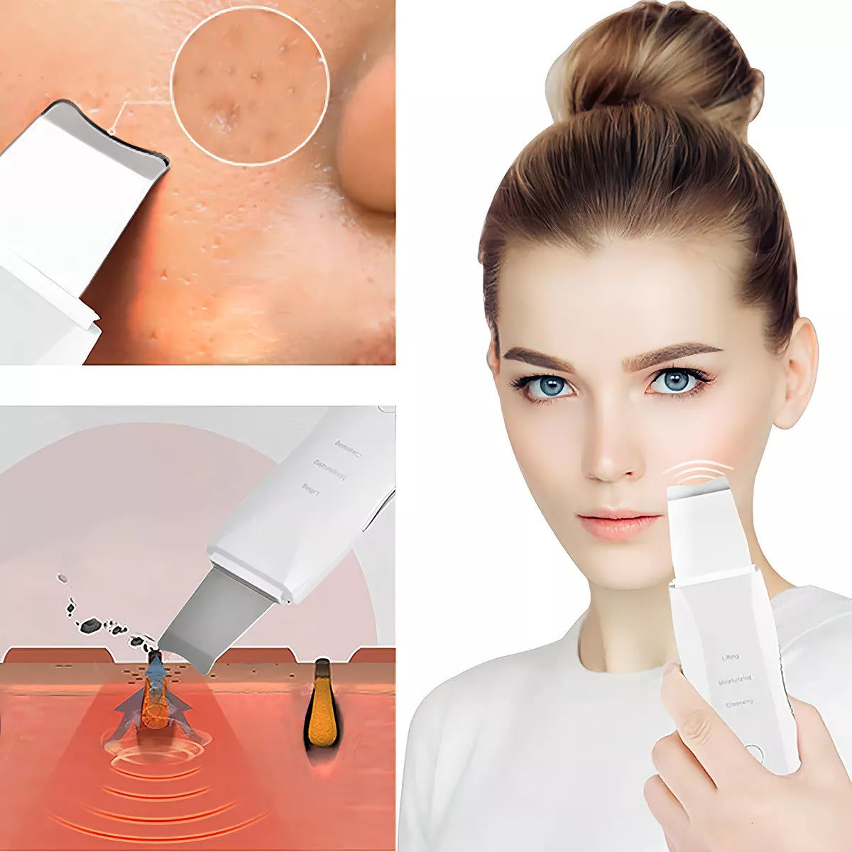 Limpiador Peeling Facial Ultrasónico – Libera tus poros, favorece la absorción y mejora la apariencia de la piel
